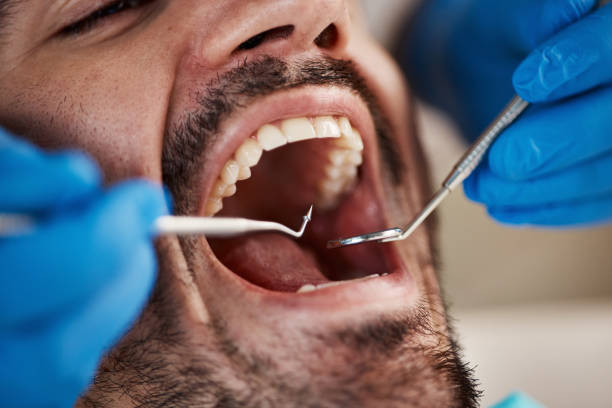 Best Broken or Chipped Tooth Repair in Circle D Kc Estates, TX